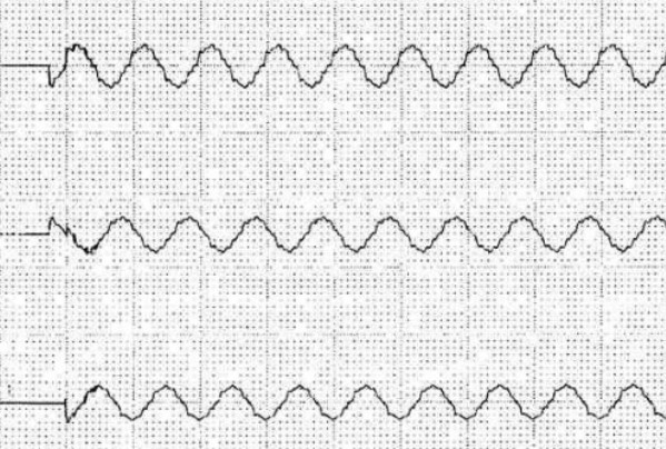 ����a�����þ��l���_�PͶ�Еr���ΈD